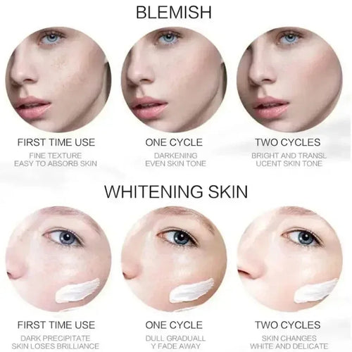Crème éclaircissante anti-taches de rousseur