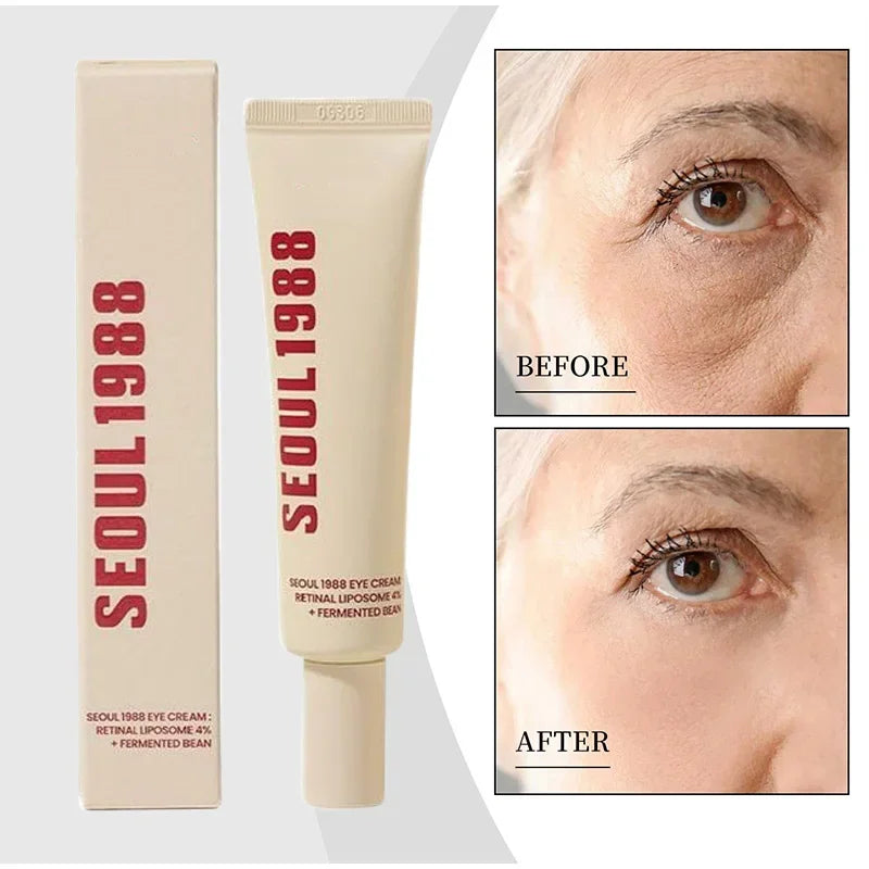 Crème Contour des Yeux Rétinol 4% Séoul 1988 – Anti-Cernes, Anti-Rides & Raffermissante